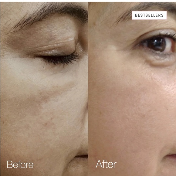 New Skin Inc My Daily Dose of Vitamins ABC Serum - Picture 8 of 9